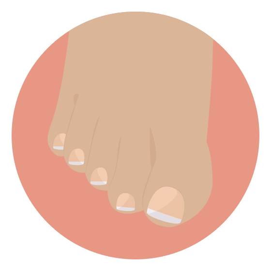 trimming and filing foot care