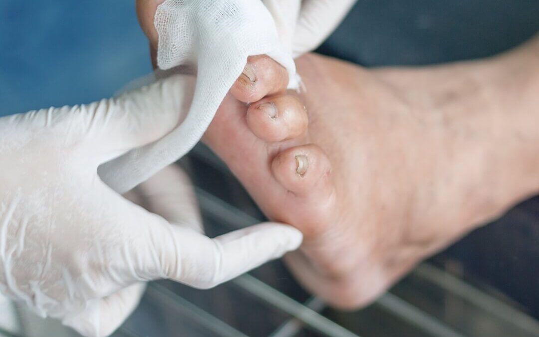 Senior Foot Care Brantford