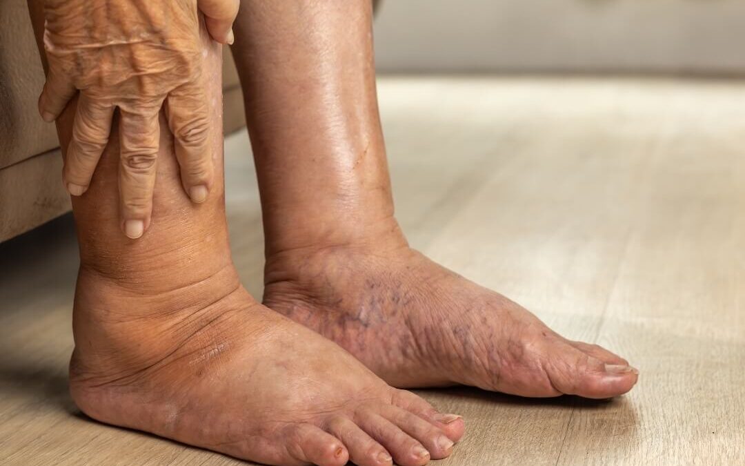 podology elderly Brantford