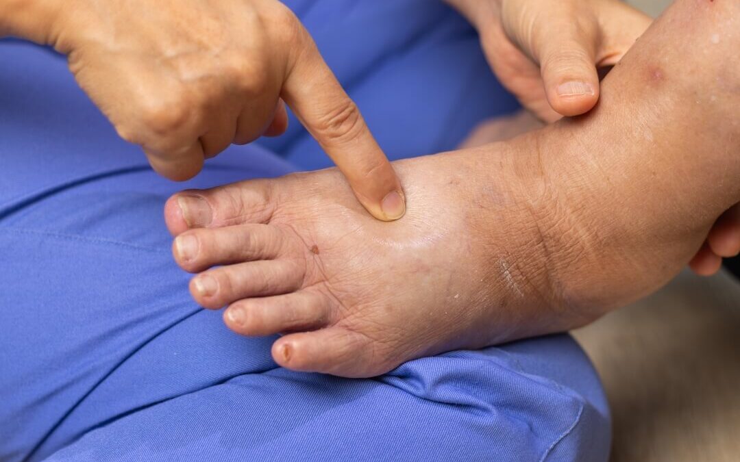 diabetic foot care