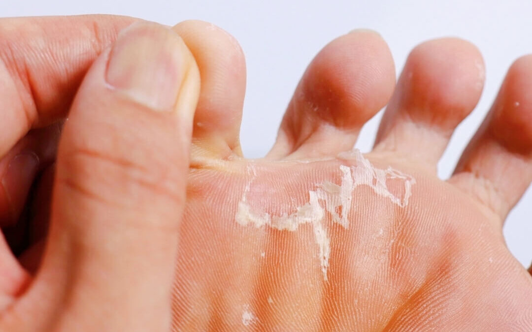 Cambridge Seniors Foot Health: How Proper Care Prevents Falls